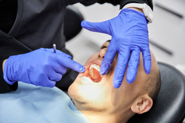 Best Dentist for Tooth Abscess  in Sierra Vista Southeast, AZ